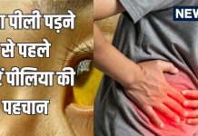 jaundice warning symptoms before yellowing skin: पीलिया के शुरुआती संकेत