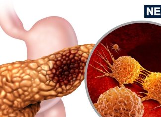 Pancreatic Cancer Treatment: सबसे जानलेवा कैंसर का इलाज मिल गया?
