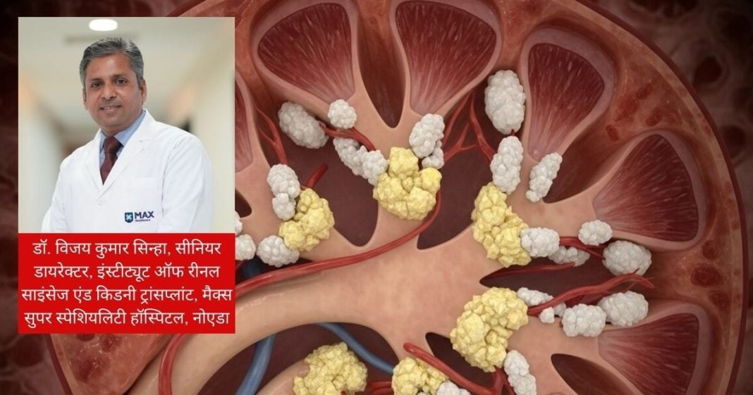My creatinine is 4.77 mg/dL: किडनी में क्रिएटिनिन बढ़ने के कारण, लक्षण और बचाव के उपाय.