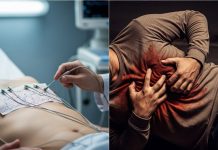 Silent Cause Of Heart Attack: ECG रिपोर्ट नॉर्मल, 3 दिन बाद हार्ट अटैक से मौत