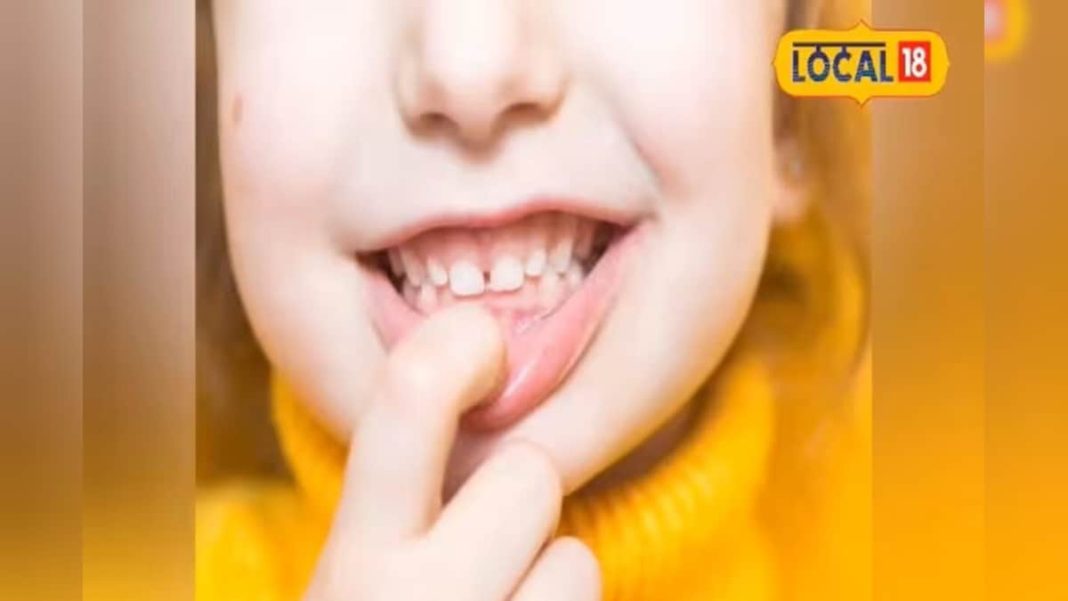 दांतों के दर्द और महंगे इलाज से मिलेगी छुट्टी! एक्सपर्ट के ये 4 टिप्स बचाएंगे आपके हजारों रुपये, आज ही अपनाएं