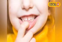 दांतों के दर्द और महंगे इलाज से मिलेगी छुट्टी! एक्सपर्ट के ये 4 टिप्स बचाएंगे आपके हजारों रुपये, आज ही अपनाएं