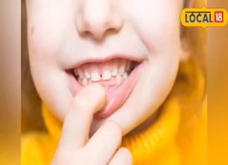 दांतों के दर्द और महंगे इलाज से मिलेगी छुट्टी! एक्सपर्ट के ये 4 टिप्स बचाएंगे आपके हजारों रुपये, आज ही अपनाएं