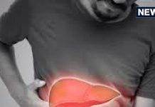 लिवर के लिए कितनी खतरनाक दर्द की ये दवा? अब सरकार ने लगा दी रोक,डॉक्टर से जान लें निमेसुलाइड के साइड-इफैक्ट्स centre bans high dose of painkiller and anti inflammatory drug nimesulide how it is dangerous for liver and kidney dr dk gupta tells