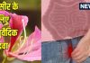 बवासीर का इलाज: कचनार की जड़ के फायदे और उपयोग तरीका