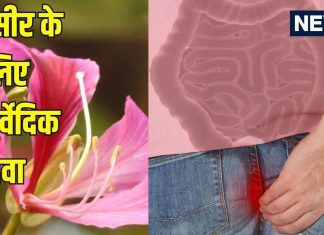 बवासीर का इलाज: कचनार की जड़ के फायदे और उपयोग तरीका