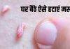 Remove Warts Naturally Without Surgery 5 Effective Home Remedies | बिना ऑपरेशन मस्से कैसे हटाएं | अनचाहे मस्से हटाने के 5 घरेलू उपाय