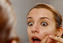 Which vitamin deficiency cause pimple, चेहरे पर पिंपल्स का कारण विटामिन की कमी जानें और समाधान.