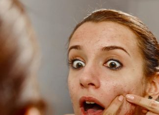 Which vitamin deficiency cause pimple, चेहरे पर पिंपल्स का कारण विटामिन की कमी जानें और समाधान.