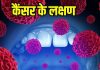 Cancer symptoms: ये छोटे-छोटे लक्षण भी कैंसर हो सकते हैं, गलती से भी न करें इग्नोर वरना…