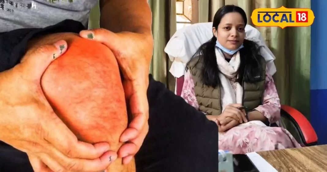 जोड़ों के दर्द और आर्थराइटिस की हो जाएगी छुट्टी, मान लीजिए पूर्णिया के डाइटीशियन की सलाह