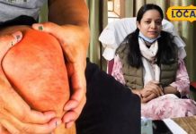 जोड़ों के दर्द और आर्थराइटिस की हो जाएगी छुट्टी, मान लीजिए पूर्णिया के डाइटीशियन की सलाह