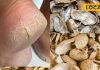 Beauty Tips : सर्दी में फटती एड़ियों ने कर रखा परेशान? मूंगफली के छिलके से बनाएं धांसू क्रीम, जानें तरीका