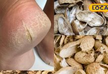 Beauty Tips : рд╕рд░реНрджреА рдореЗрдВ рдлрдЯрддреА рдПрдбрд╝рд┐рдпреЛрдВ рдиреЗ рдХрд░ рд░рдЦрд╛ рдкрд░реЗрд╢рд╛рди? рдореВрдВрдЧрдлрд▓реА рдХреЗ рдЫрд┐рд▓рдХреЗ рд╕реЗ рдмрдирд╛рдПрдВ рдзрд╛рдВрд╕реВ рдХреНрд░реАрдо, рдЬрд╛рдиреЗрдВ рддрд░реАрдХрд╛