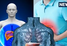 5 stomach symptoms related to fatty liver: फैटी लिवर के शुरुआती लक्षण