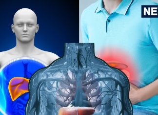 5 stomach symptoms related to fatty liver: फैटी लिवर के शुरुआती लक्षण