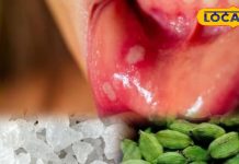 दादी-नानी का देसी नुस्खा! मिश्री और इलायची से ऐसे बनाएं पेस्ट, मुंह के छालों में मिलेगा आराम