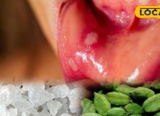 दादी-नानी का देसी नुस्खा! मिश्री और इलायची से ऐसे बनाएं पेस्ट, मुंह के छालों में मिलेगा आराम