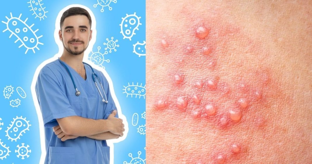 शरीर के इन हिस्सों पर निकल आते हैं छोटे-छोटे दाने, हर्पीज वायरस का हो गए शिकार, क्या है इसका इलाज?