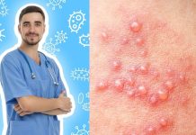 शरीर के इन हिस्सों पर निकल आते हैं छोटे-छोटे दाने, हर्पीज वायरस का हो गए शिकार, क्या है इसका इलाज?