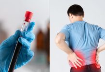 क्या ब्लड टेस्ट से भी लगाया जा सकता है किडनी स्टोन का पता? एक्सपर्ट क्यों देते हैं अल्ट्रासाउंड की सलाह