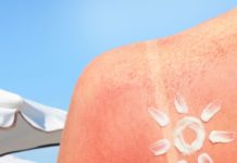 Summer Tips: स्किन जला देने वाली धूप से कैसे बचें? फॉलो करें ये कूलिंग टिप्स