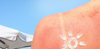 Summer Tips: स्किन जला देने वाली धूप से कैसे बचें? फॉलो करें ये कूलिंग टिप्स